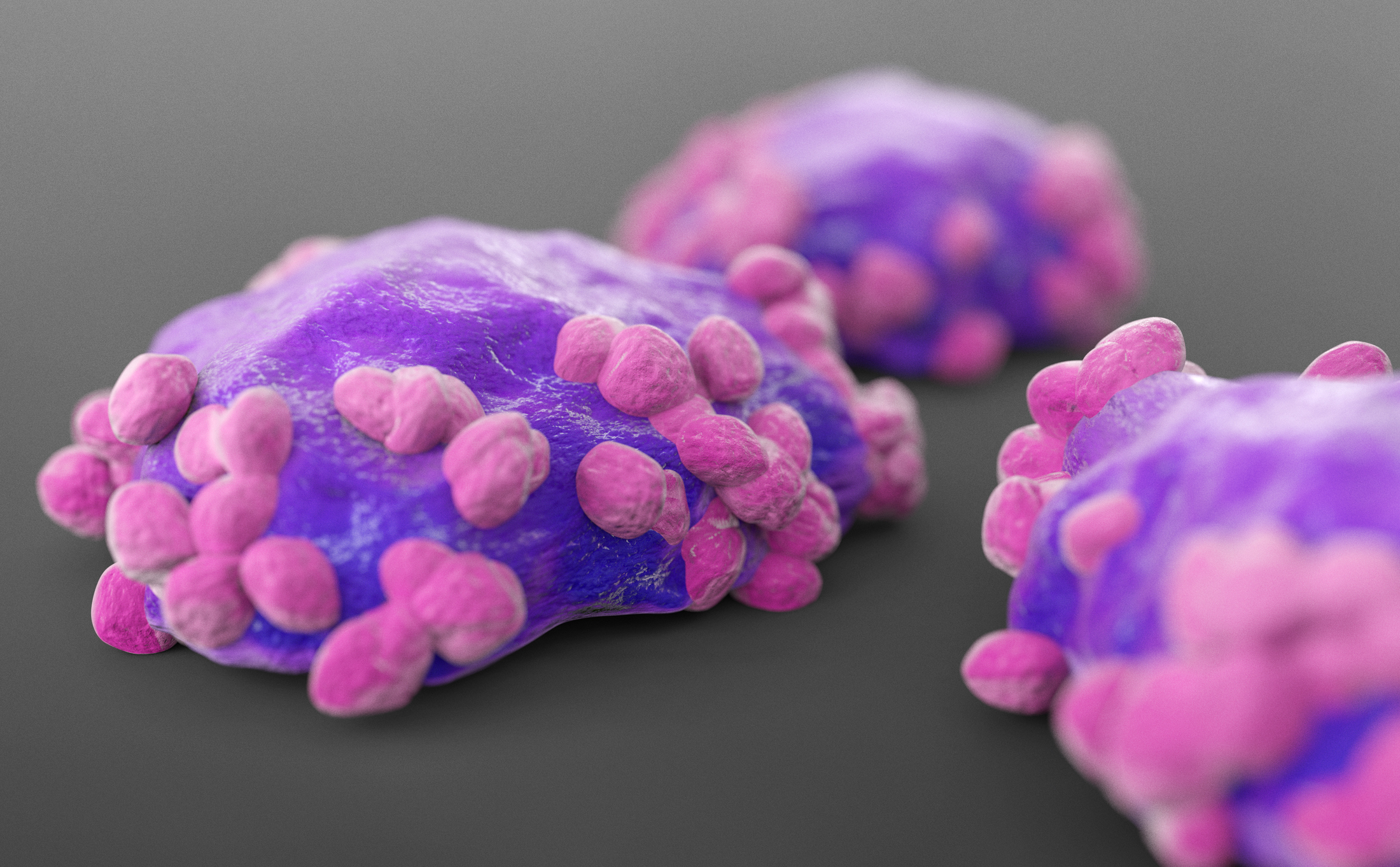 Lymphoma cells