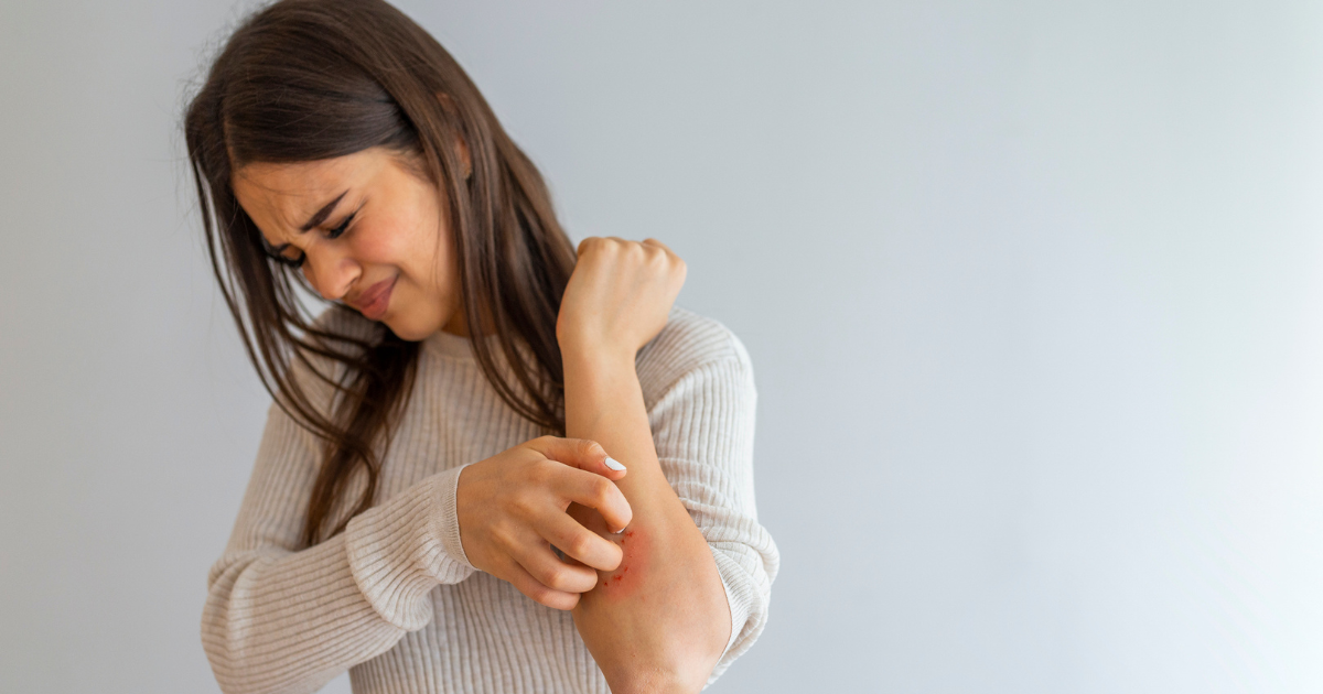 Woman scratching her arm