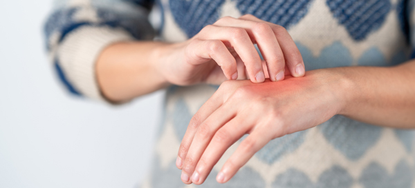 How do I know if I have Psoriasis or Eczema?