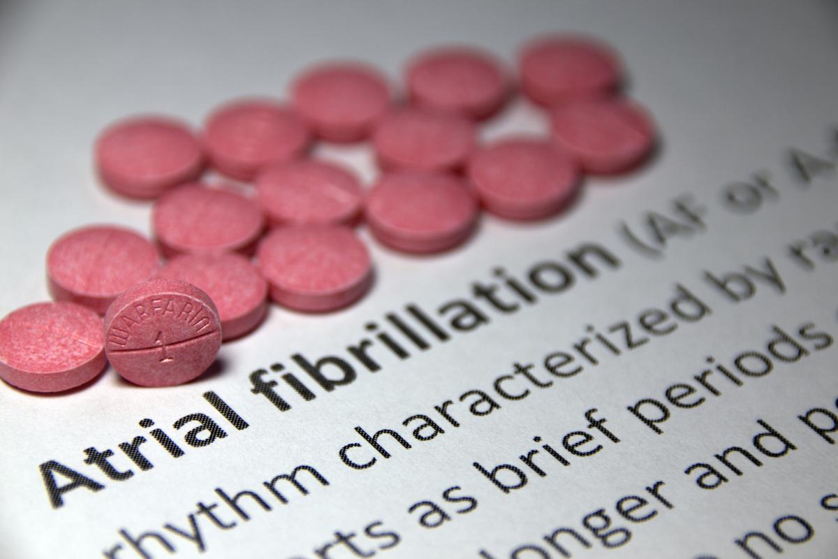 Description of atrial fibrillation