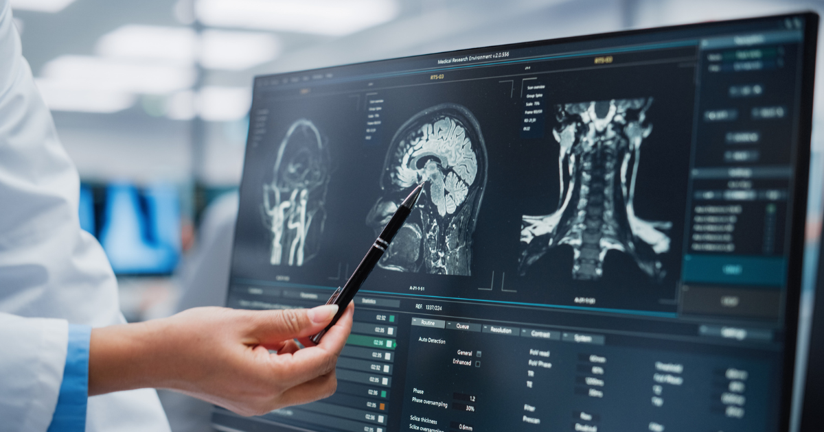 Doctor pointing to brain scan