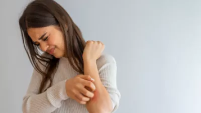 Woman scratching her arm