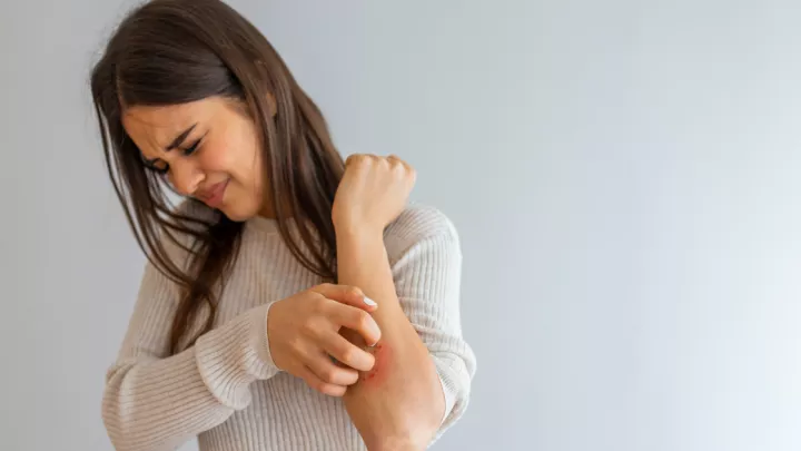 Woman scratching her arm