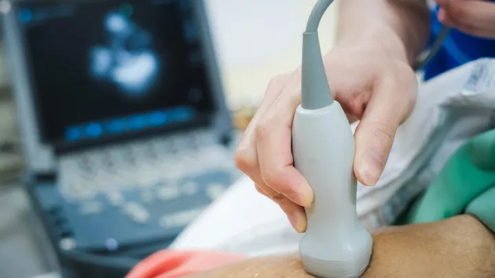 Echocardiogram