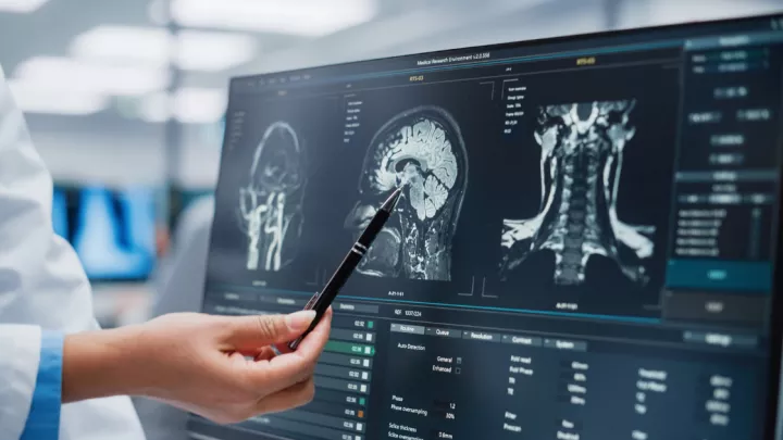 Doctor pointing to brain scan