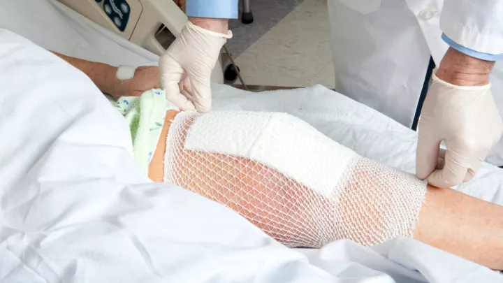 Doctor adjusting knee replacement bandage