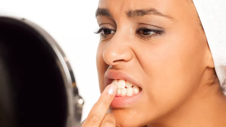 Woman looking at her teeth in a mirror