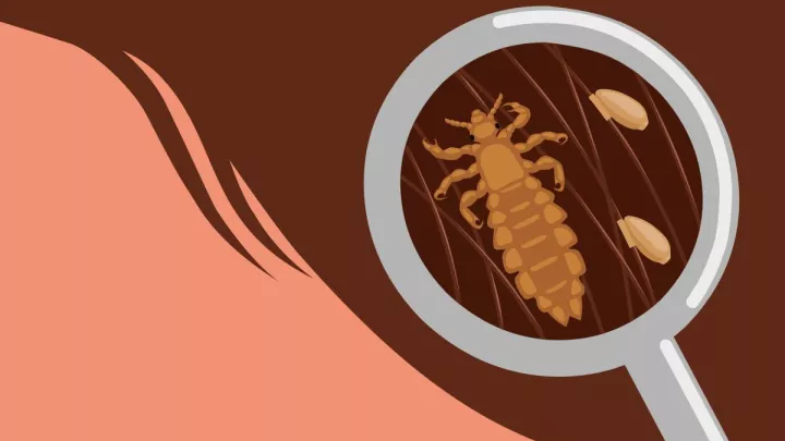 Cartoon lice