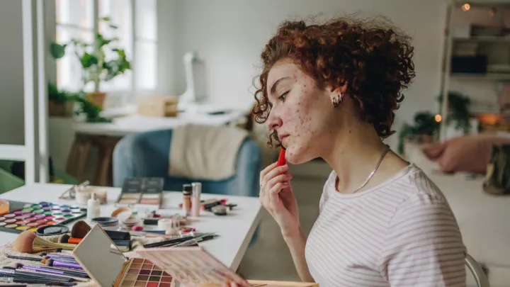 Young woman with acne applying makeup