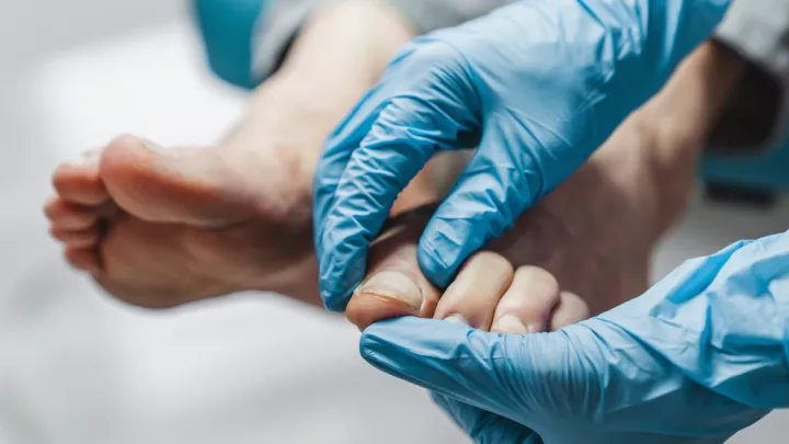 Gloved hands inspecting toenail
