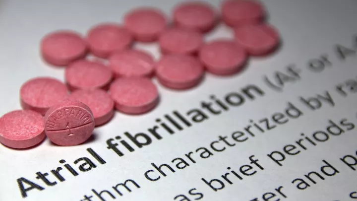 Description of atrial fibrillation