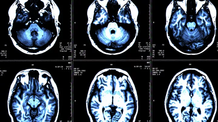 Brain scans
