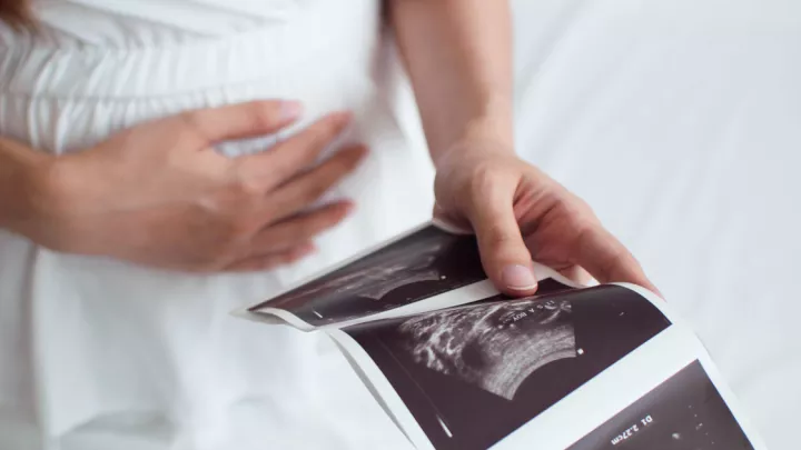 picture of a pregnant woman looking at ultrasound images