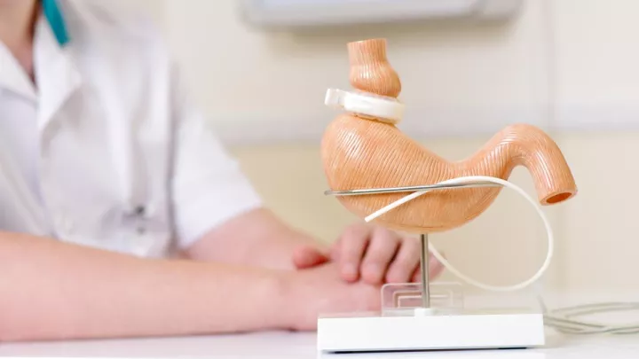 Medical model of stomach with Lap-Band